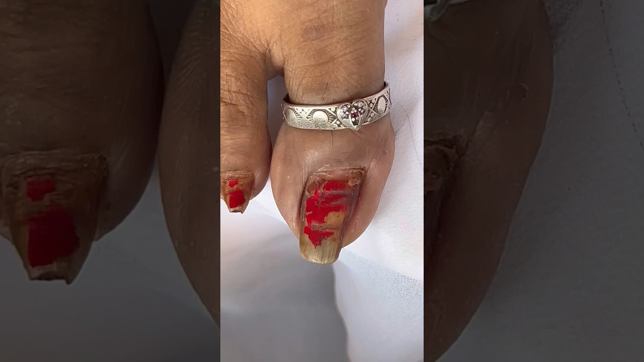 ASMR nail cleaning #asmr #oddlysatisfying #triggersforsleep #oddlysatisfying #pedicure