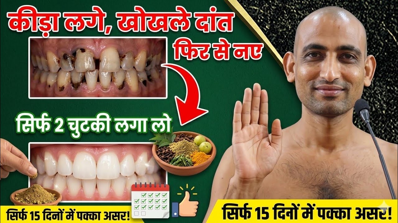 ये आयुर्वेदिक दन्त मंजन लगा लो - कीड़ा लगे, पीले, खोखले दांत फिर से नए कर देगा | Teeth Cavity