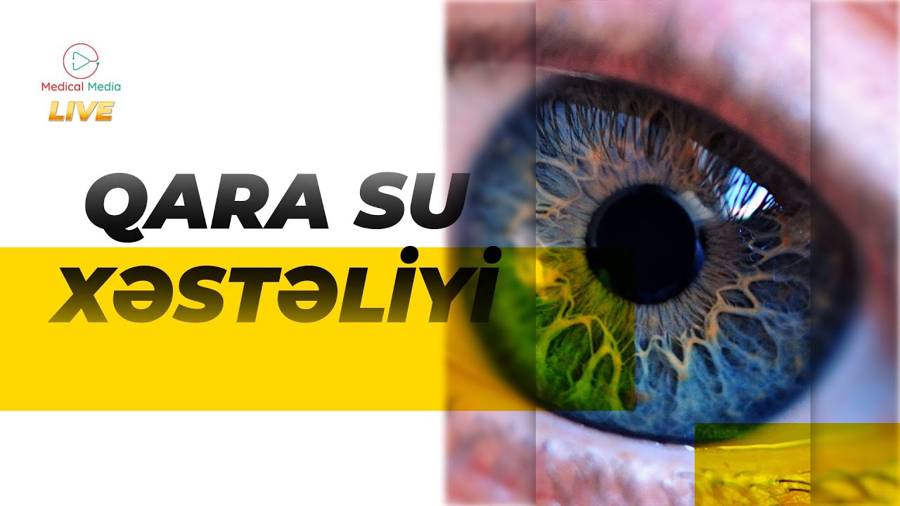 QLAUKOMA / GÖZ XƏSTƏLİKLƏRİ / QARA SU XƏSTƏLİYİ / GÖZ XƏSTƏLİKLƏRİNİN MÜALİCƏSİ