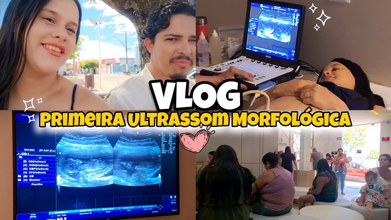 ULTRASSOM MORFOLÓGICA DO PRIMEIRO TRIMESTRE😍🤏  Deu Pra Ver Se é Menino ou Menina?○? & Pré Natal✨️