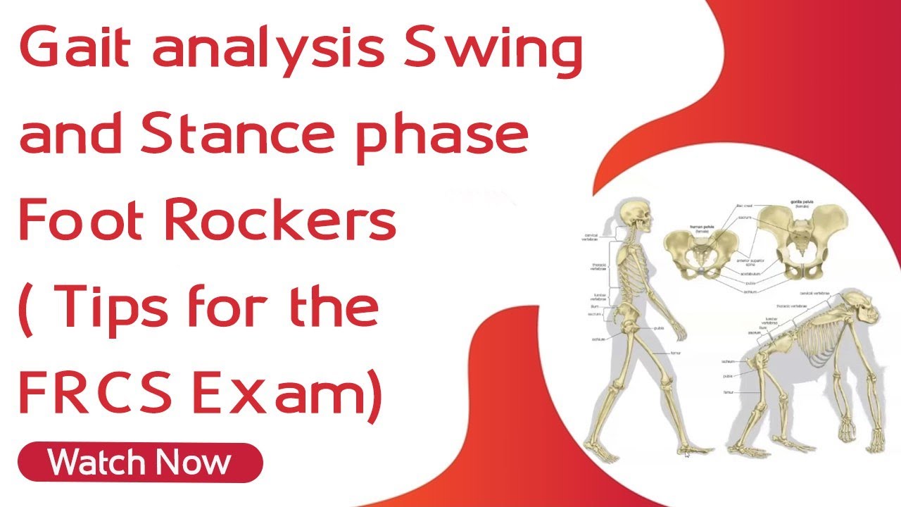 Gait analysis | Swing and Stance phase | Foot Rockers ( Tips for the FRCS Exam)