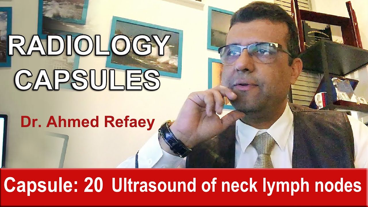Capsule : 20 - Ultrasound of neck lymph nodes