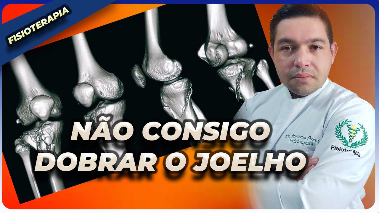 Meu JOELHO não dobra depois da CIRURGIA de FRATURA na TÍBIA
