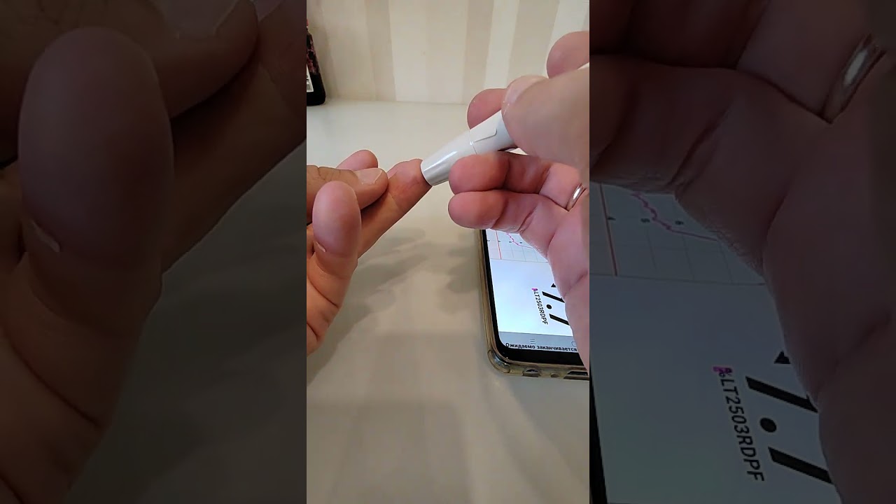 Наглядный пример как сенсор может отставать от глюкометра