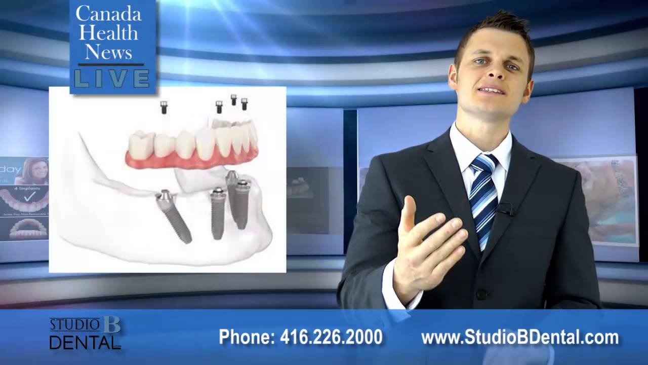 Permanent Teeth-in-1-Day Toronto | Same Day Teeth Implants Toronto | Best Dental Implants Toronto