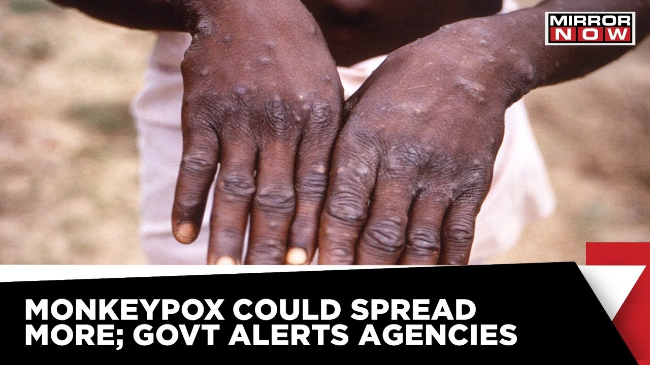 Monkeypox Outrage | Government Alerts NCDC, ICMR To Close Watch | World News | Latest Update