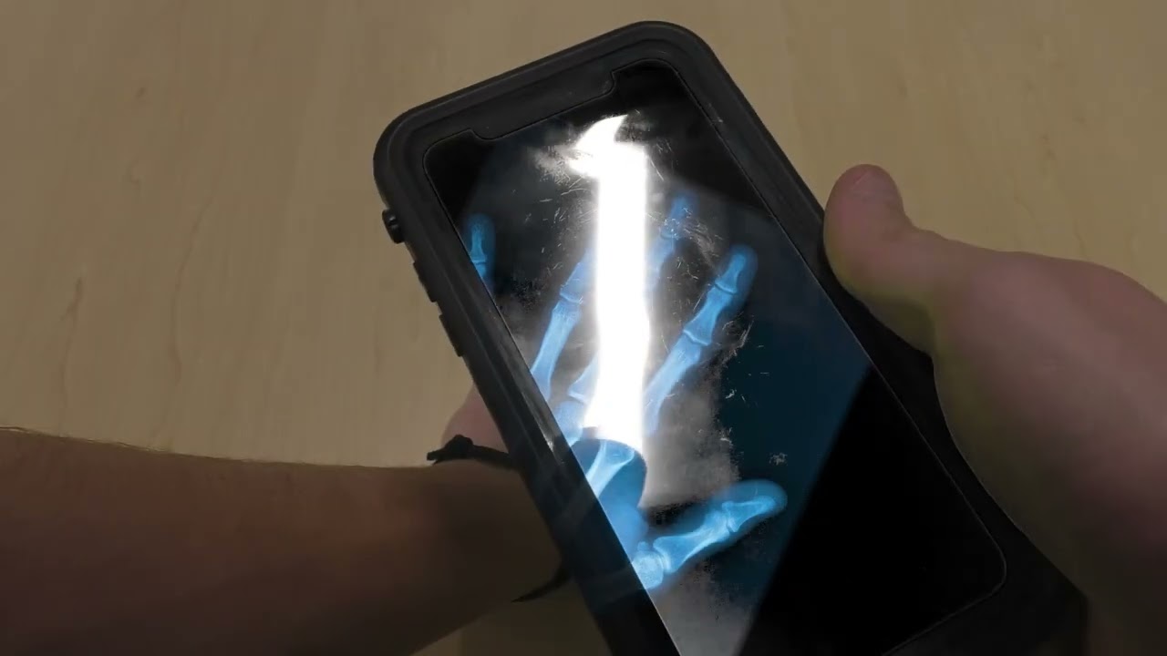 Xray App