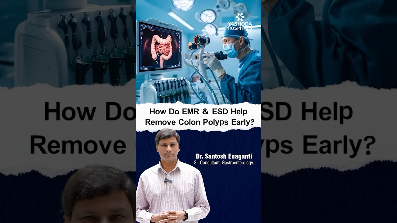 How do EMR and ESD help remove colony polyps early? - Dr. Santosh Enaganti