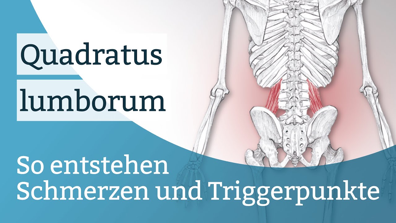 Quadratus lumborum Schmerzen, Triggerpunkte und deren Aktivierung