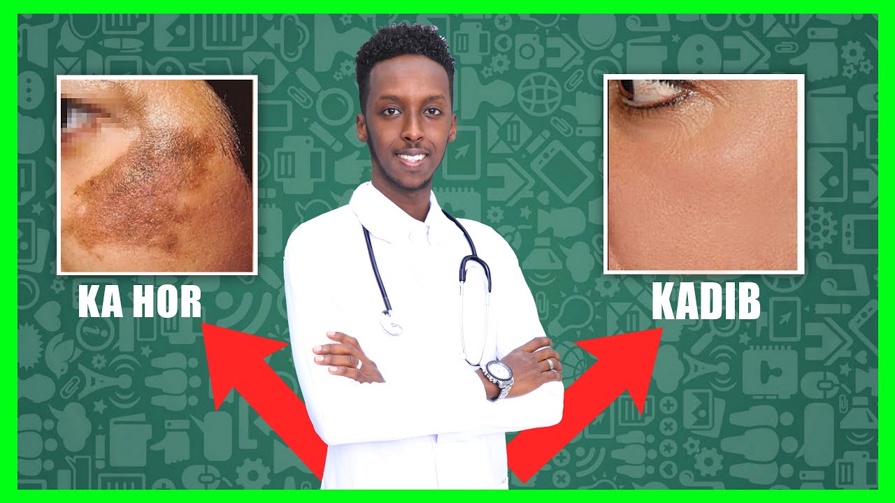HAARAHA WAJIGA IYO SIDA DABIICIGA EE LOO DAWEEYO.