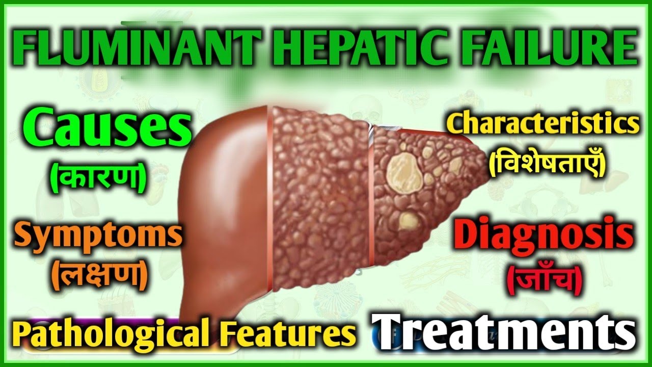 FLUMINANT HEPATIC FAILURE | Causes | Patho| Symptoms | Investigation | Treatments |