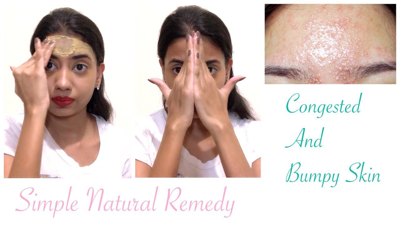 How to get rid of Small Bumps on Forehead&Bumpy Skin Quickly