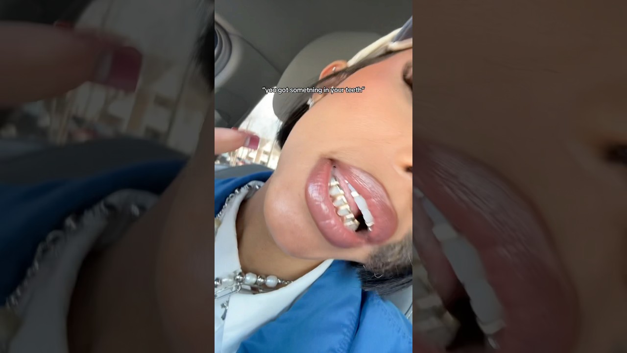 something on my teeth you say? 😅✨ #grillz #goldgrillz #diamondg
