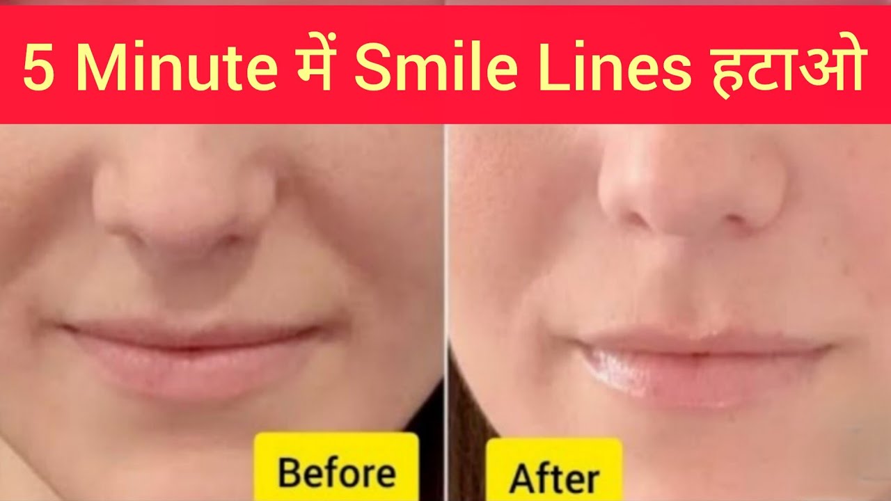 Remove Smile Lines & Jowls in Just 5 Minutes | Face exercises (हिंदी में) | FaceLiftBySunita 