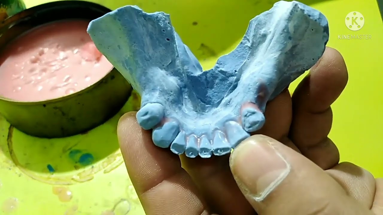 como aliviar tus modelos para prótesis dentales flexibles🙀