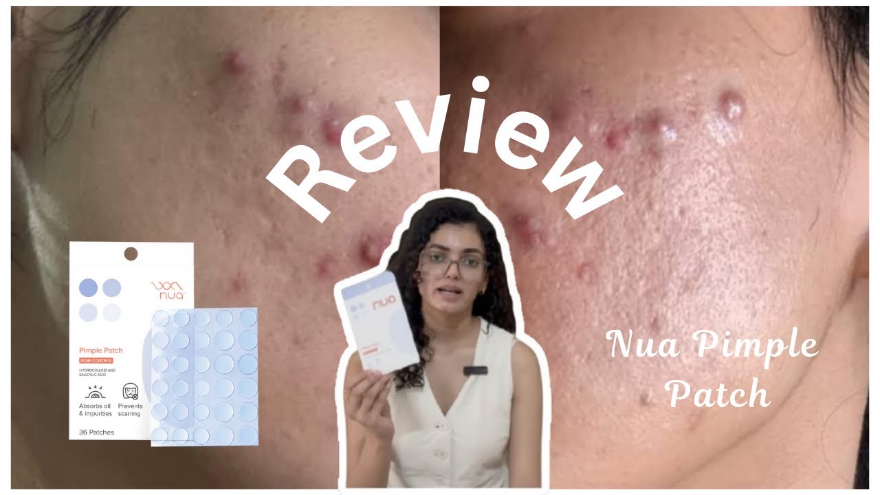Does Nua Hydrocolloid Salicylic acid Pimple Patch work? | Ingredient breakdown & Review