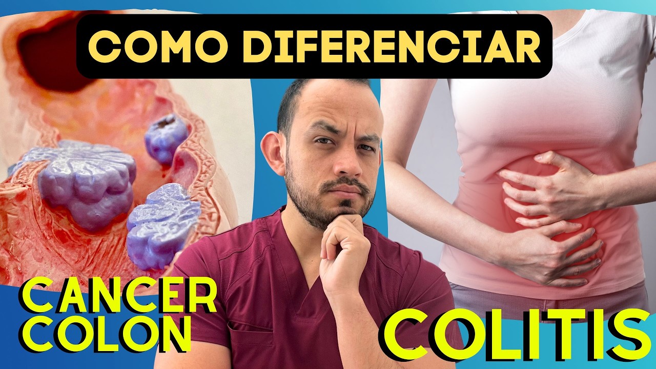 Diferencias en los Síntomas de Cáncer de Colon vs Colitis. Estudios que se pueden realizar.