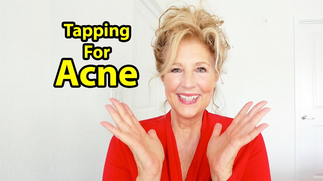 TAPPING FOR ACNE #eft #tapping #apainplan