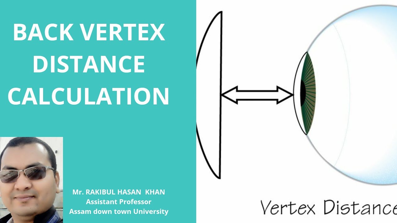 BACK VERTEX DISTANCE CALCULATION