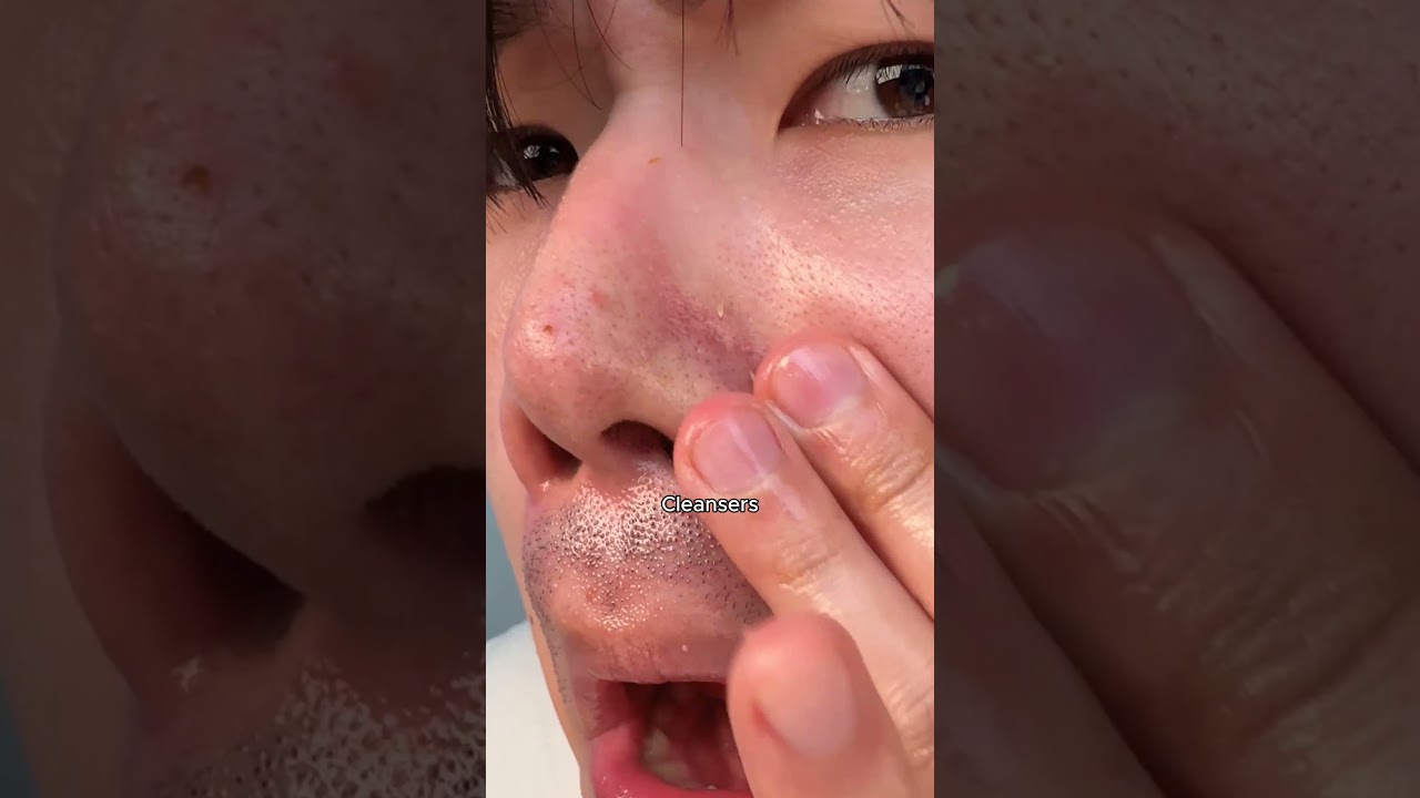 before i started skincare..  #skincare #kskincare #skincareroutine #beforeandafter #orien #skin1004