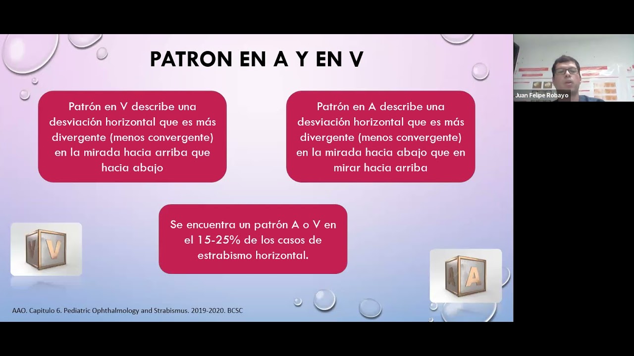 Estrabismo con patron A y V Dr. Juan Felipe Robayo