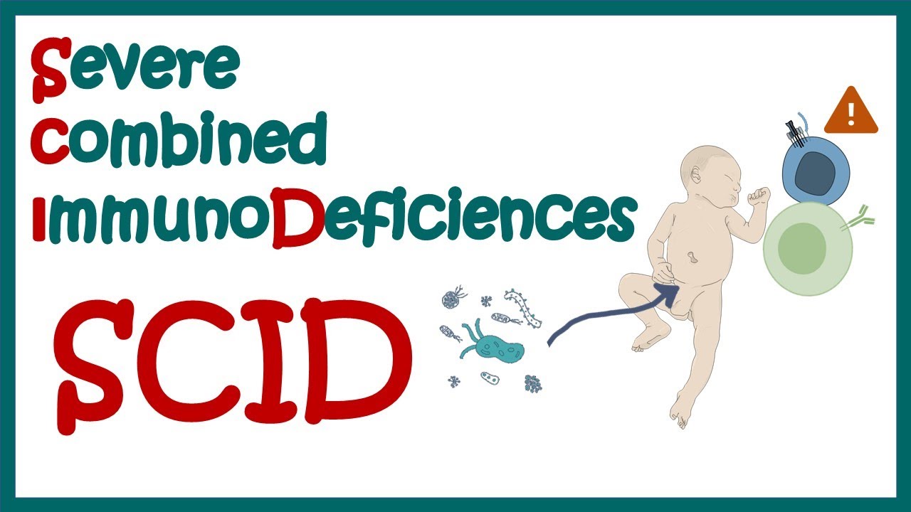 SCID (Severe combined immunodeficiency) || symptoms and immunology || Immunodeficiency