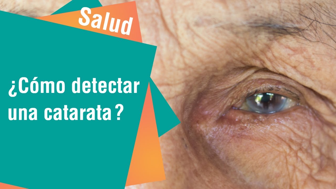 &iquest;C&oacute;mo detectar una catarata? | Salud