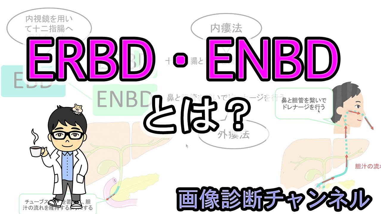 医療用語のERBD,ENBDとは？図を用いてわかりやすく解説！