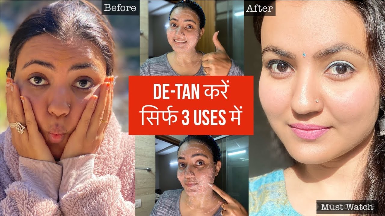 DeTan In 3 Uses : Remove करें ज़िद्दी काली परत Sun Tan और पाएं चमकदार Bright Skin सिर्फ 3 Uses में 💕