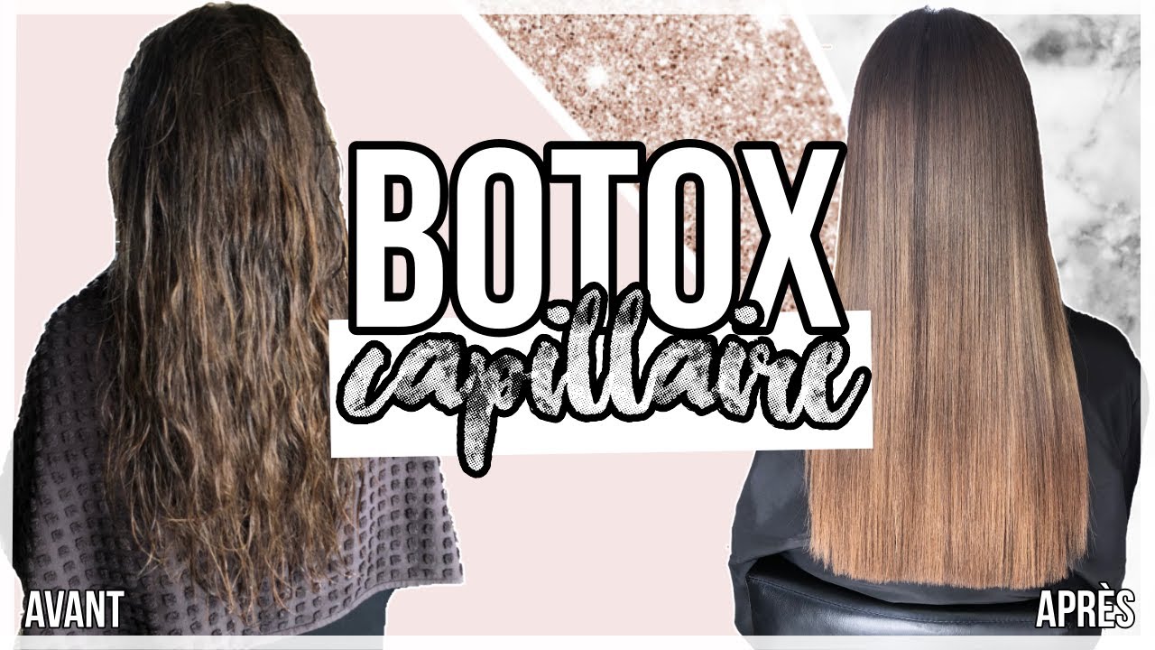 JE TESTE LE BOTOX ! 1 MOIS PLUS TARD ?! 😱🤩