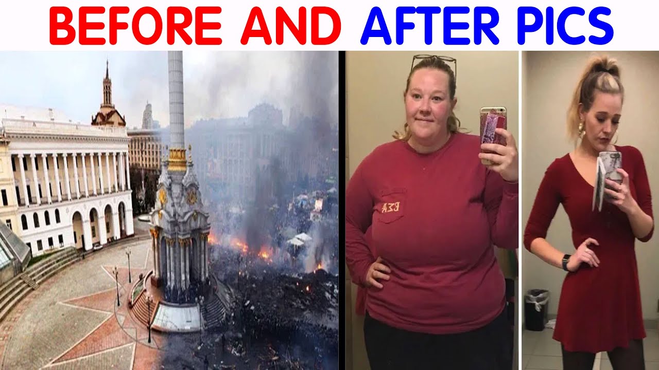 49 Of The Most Dramatic Before And After Pics