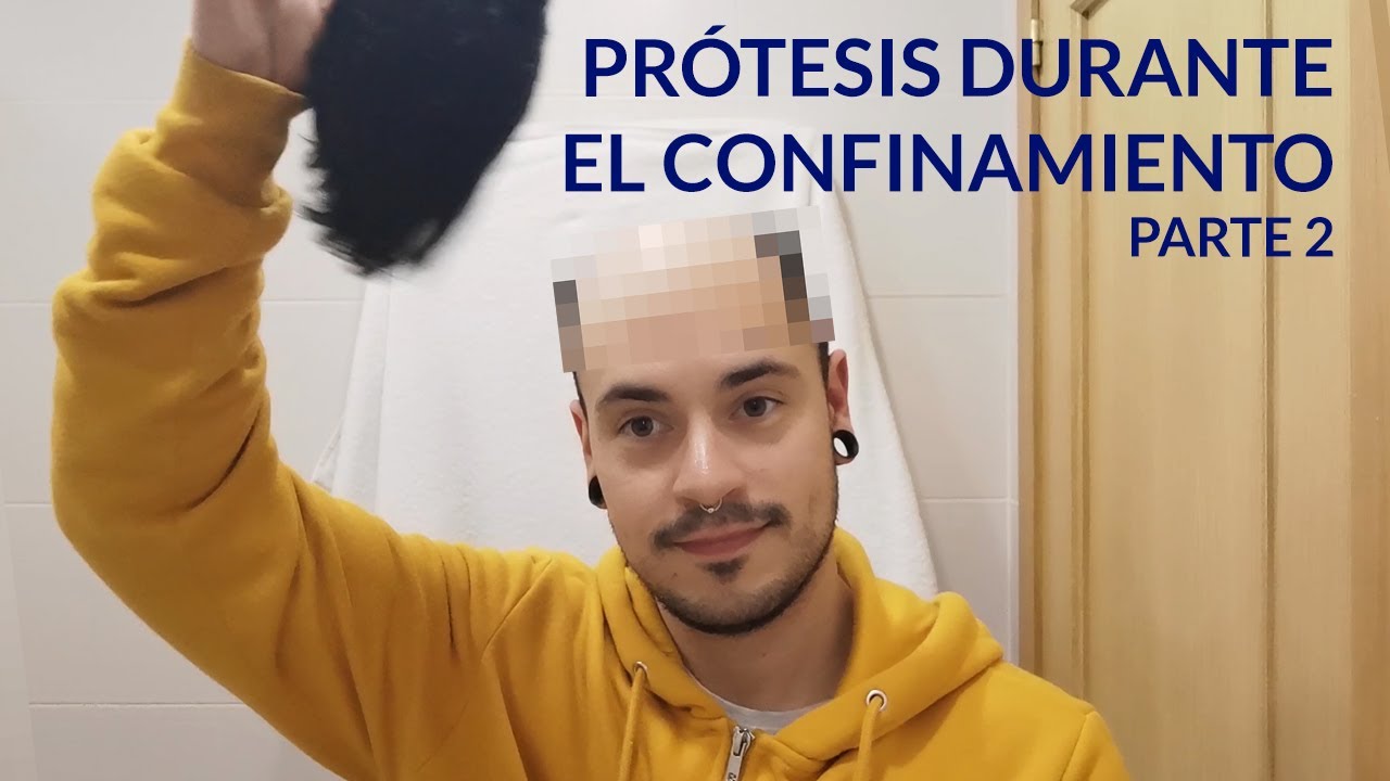 Vlog Prótesis Capilares - Hair replacement | Poner la prótesis en 30