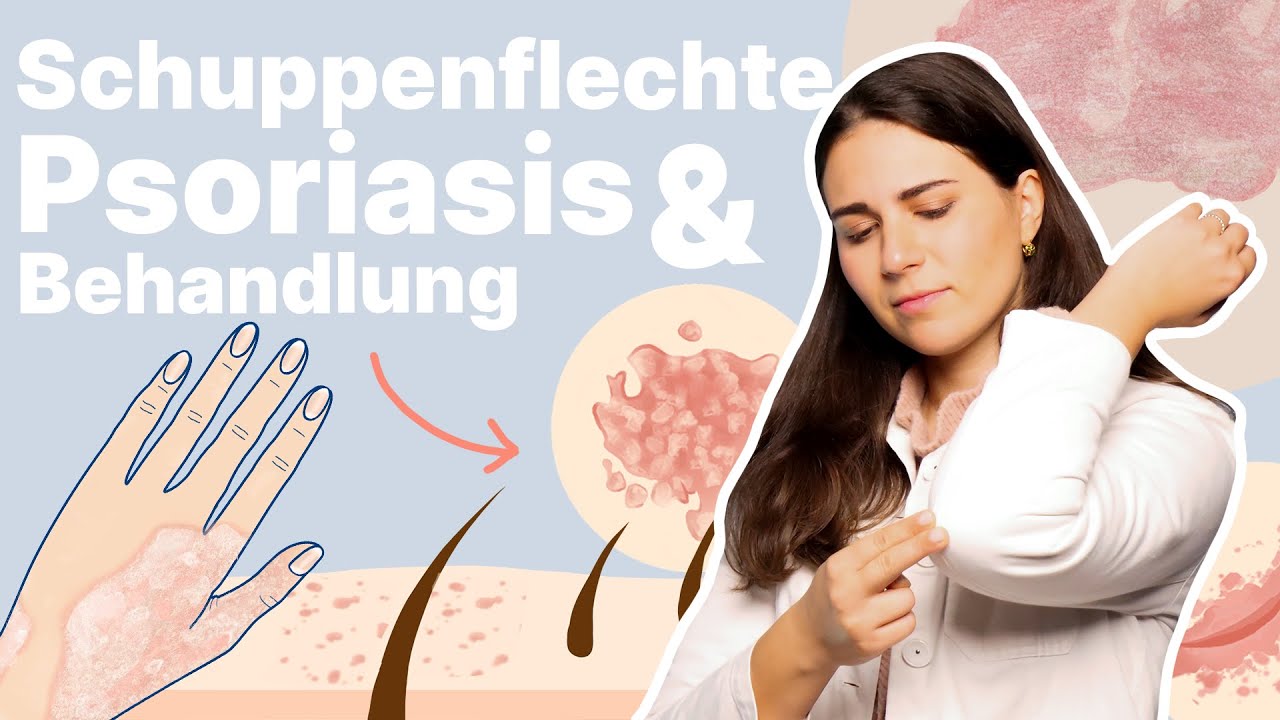 Schuppenflechte an der Kopfhaut, beim Kind oder im Gesicht. Wie behandeln?│Dr. med. Alice Martin