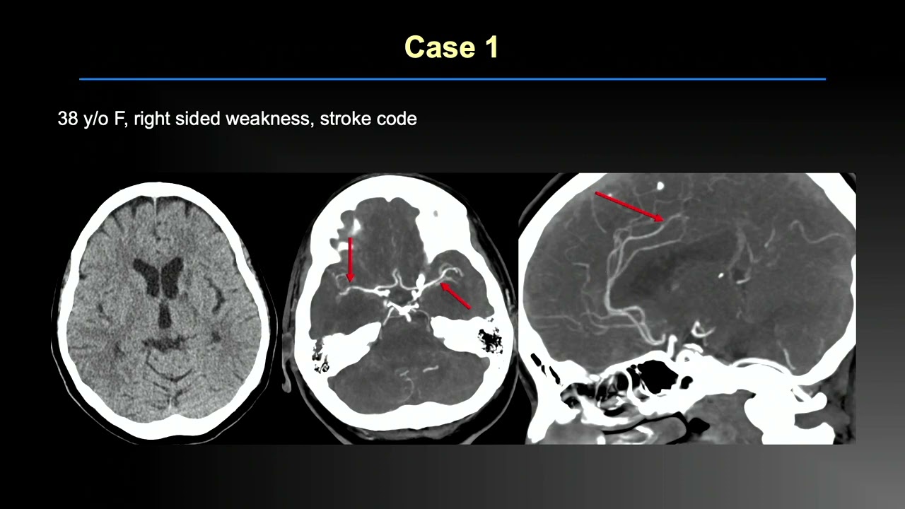 2025 MR and CT Advanced Imaging and Artificial Intelligence