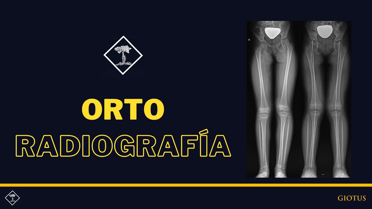 Ortorradiografía - GIOTUS