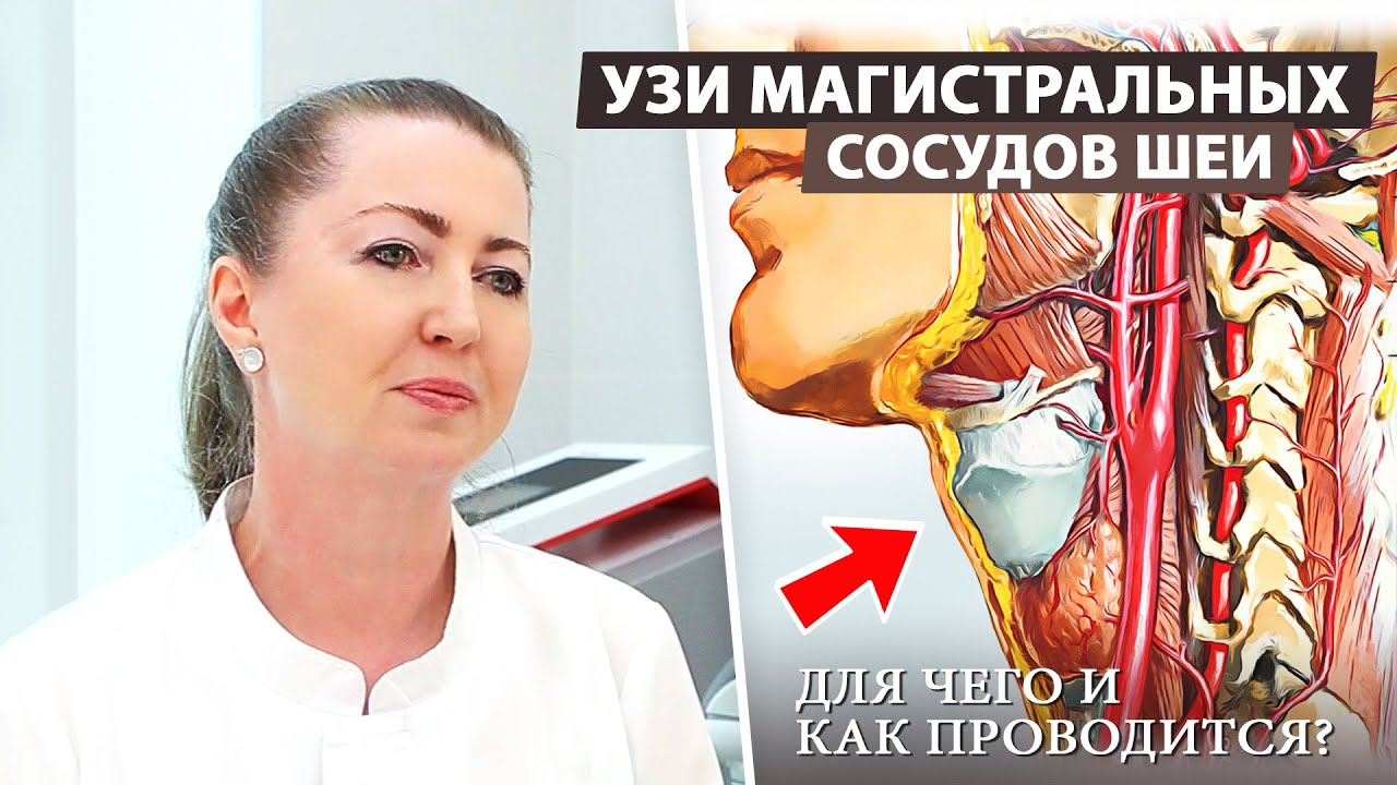 УЗИ сосудов шеи: почему это важно для вашего здоровья?