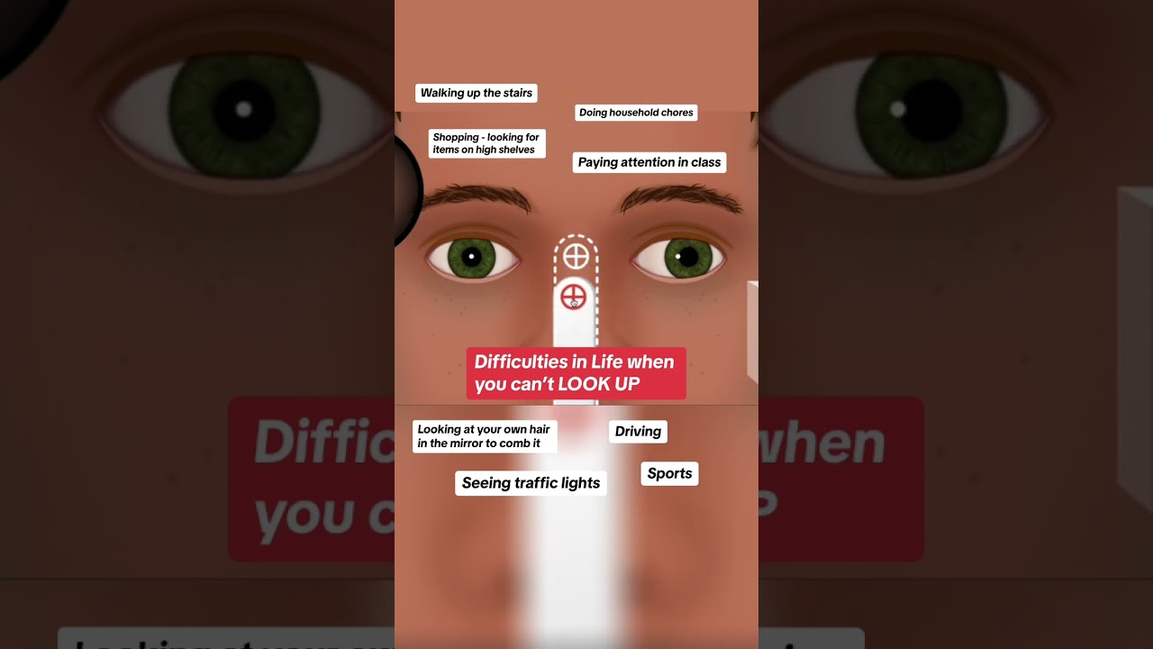 Diagnose the BVD: When you can’t LOOK UP… 