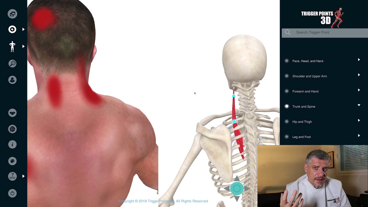 Splenius Cervicis - Trigger Point of the Week