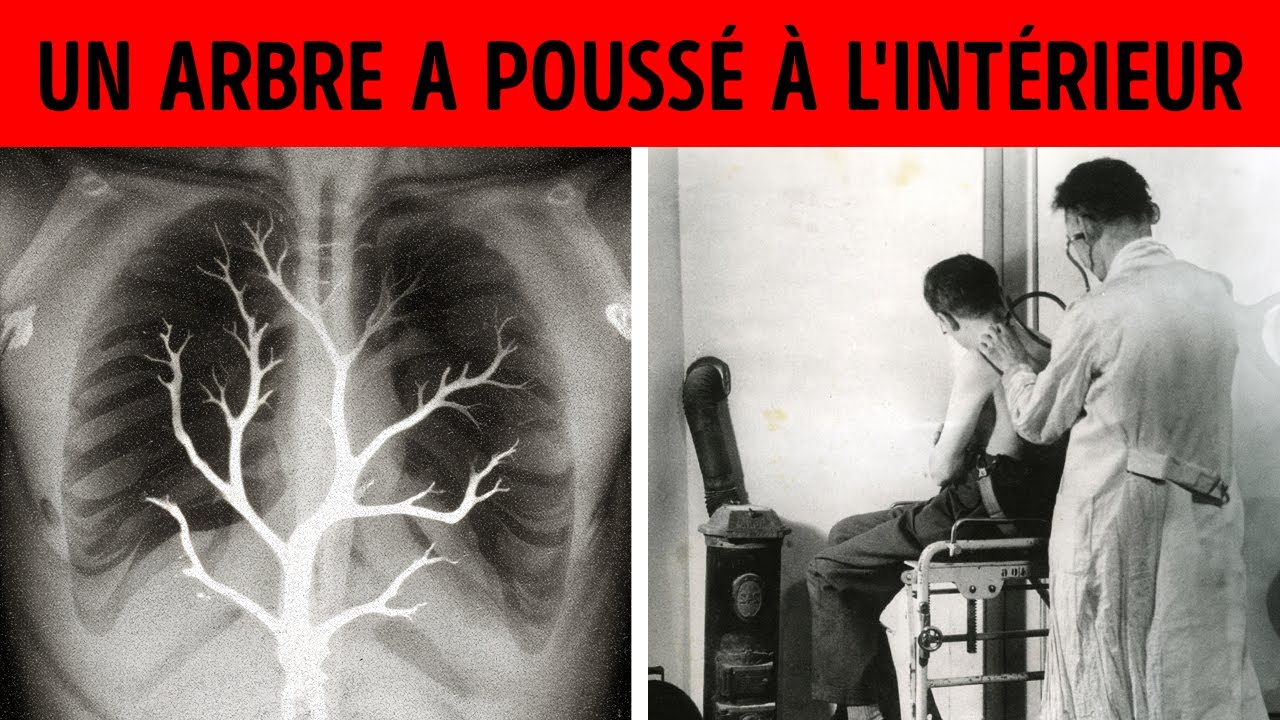 Histoires vraies qui défient la logique et l'explication, mais qui sont toutes réelles