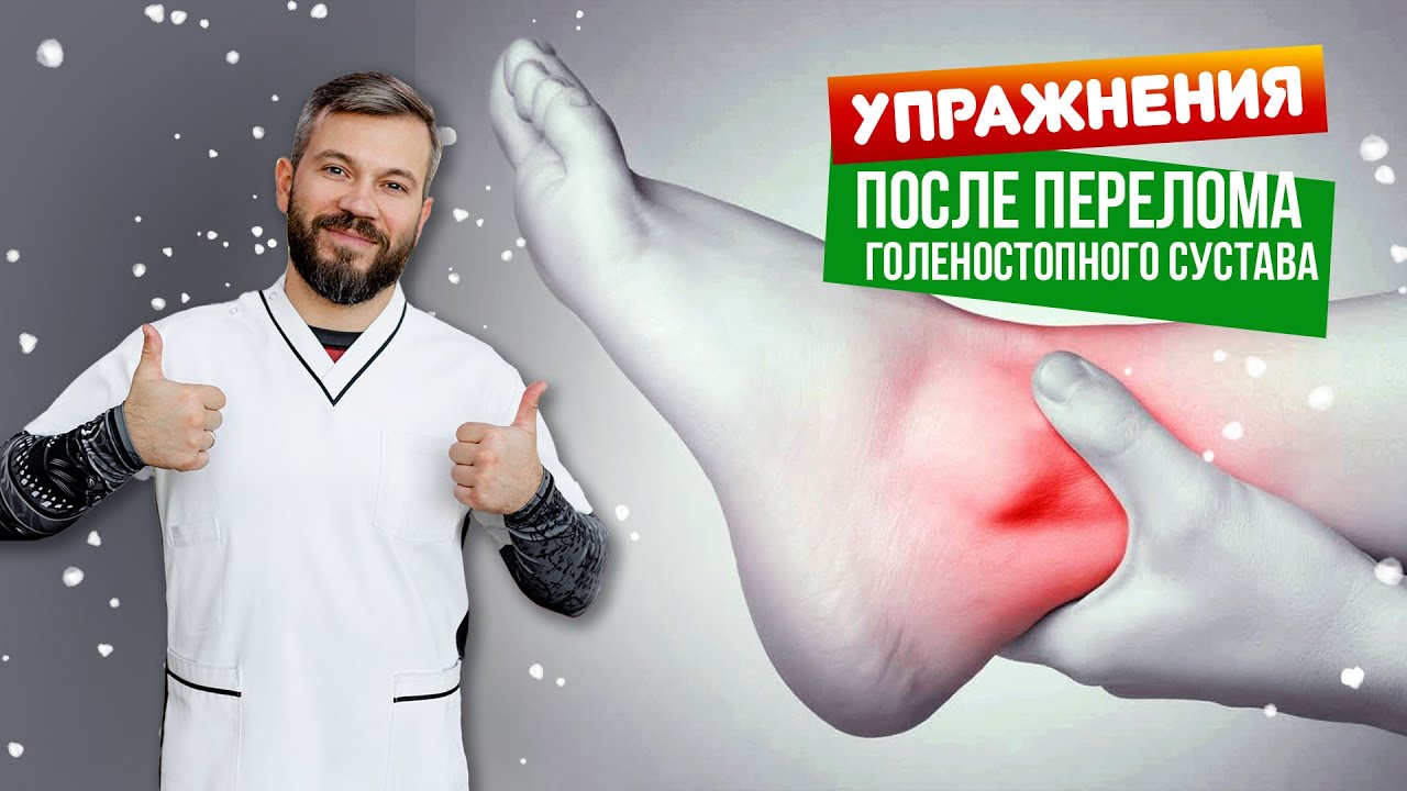 Упражнения для восстановления голеностопного сустава после перелома.
