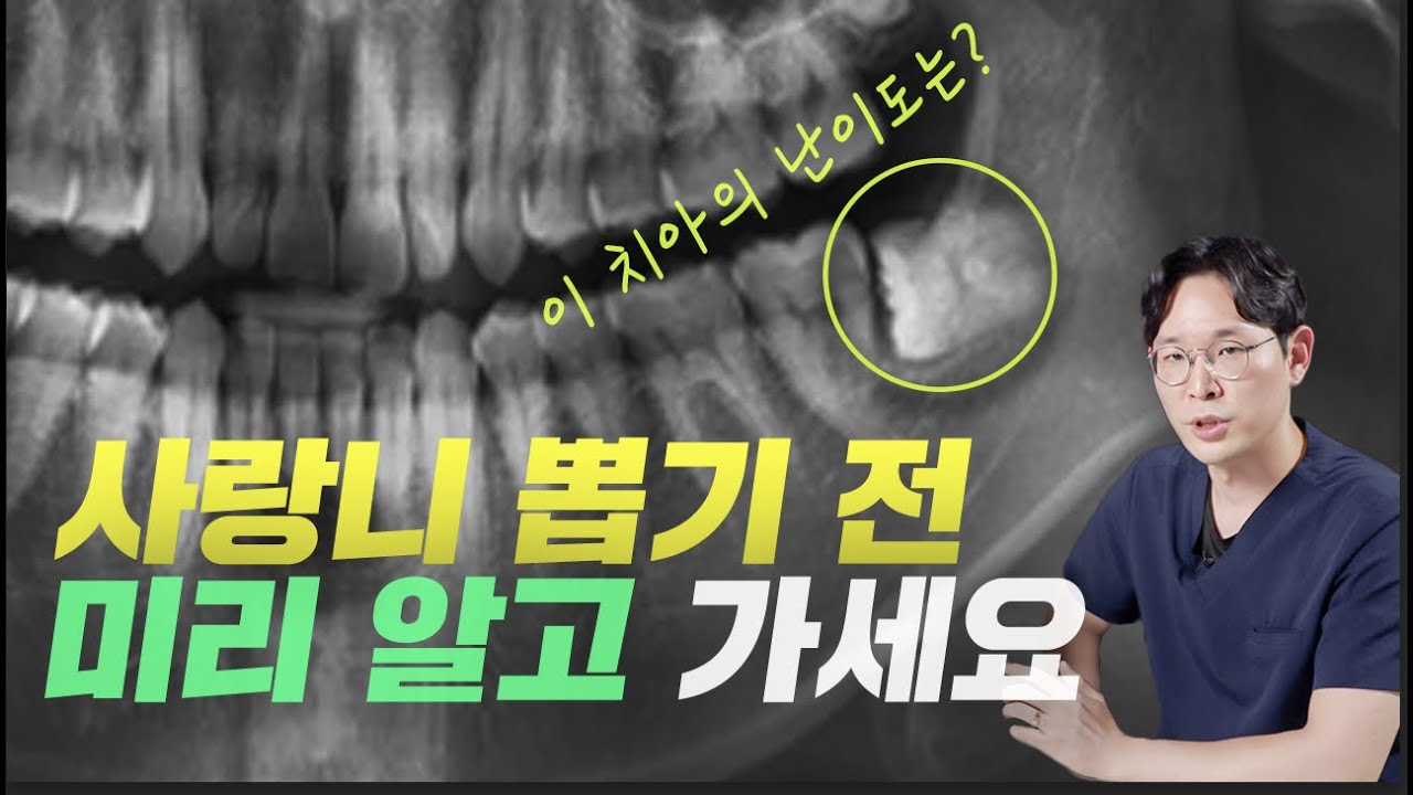 사랑니 자가진단 같이해봐요!✌️ | 케이스마다 난이도가 다른 매복 사랑니