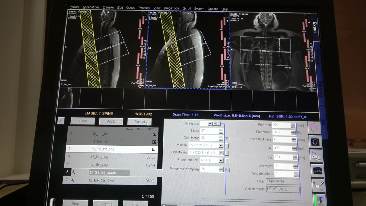 Basic T-Spine MRI