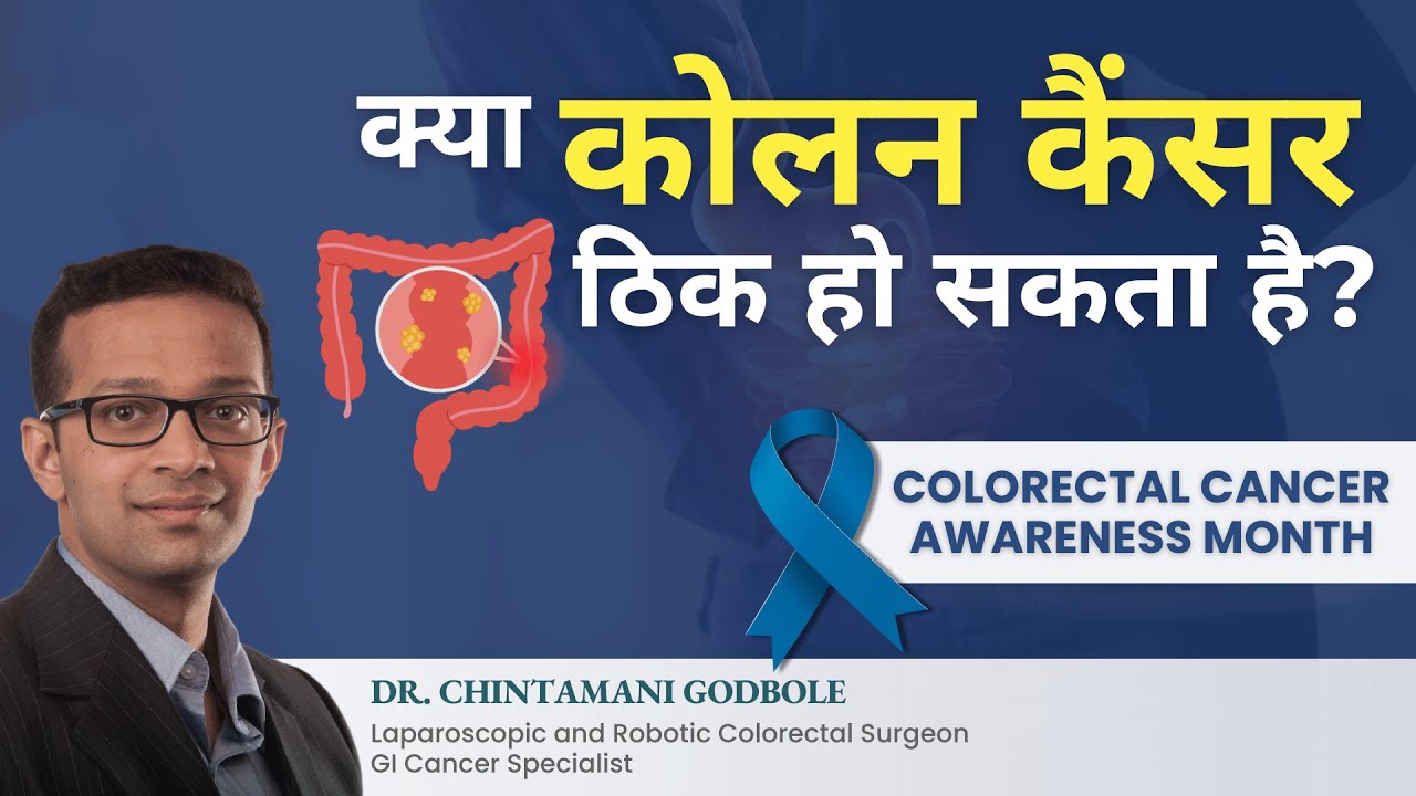 Colon Cancer life expectancy | Colon Cancer survival rate | डॉ. चिंतामणि गोडबोले