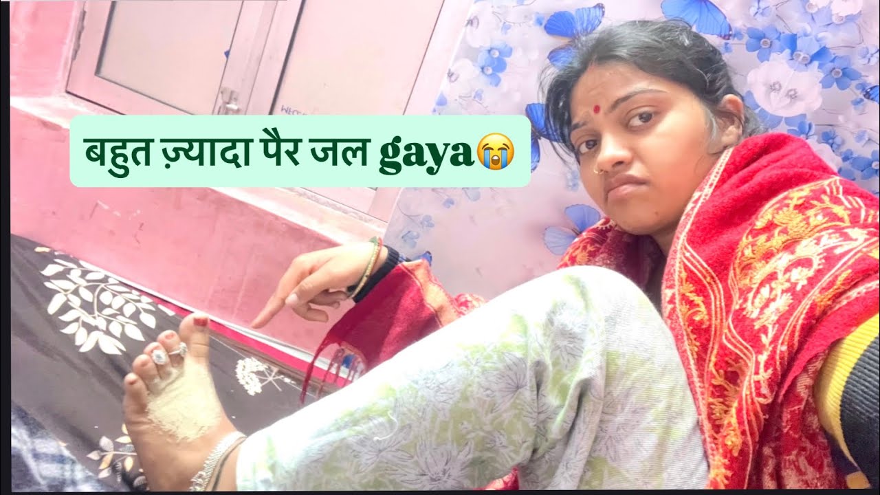 बहूत ज़्यादा पैर जल गया मेरा दोस्तों😭😭