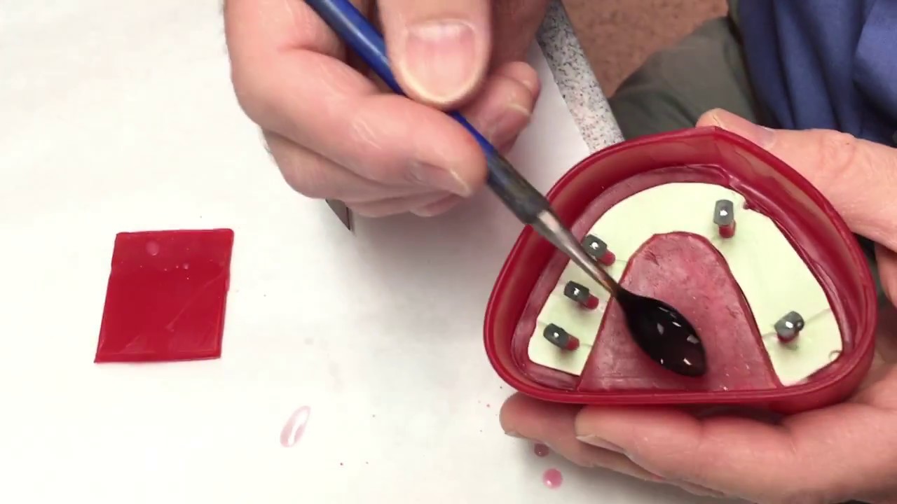 Boxing the pinned cast to pour the base