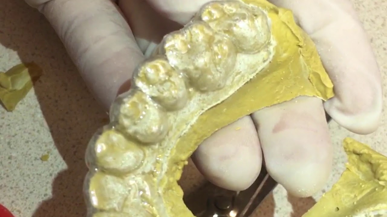Learn to Fabricate Essix Retainer