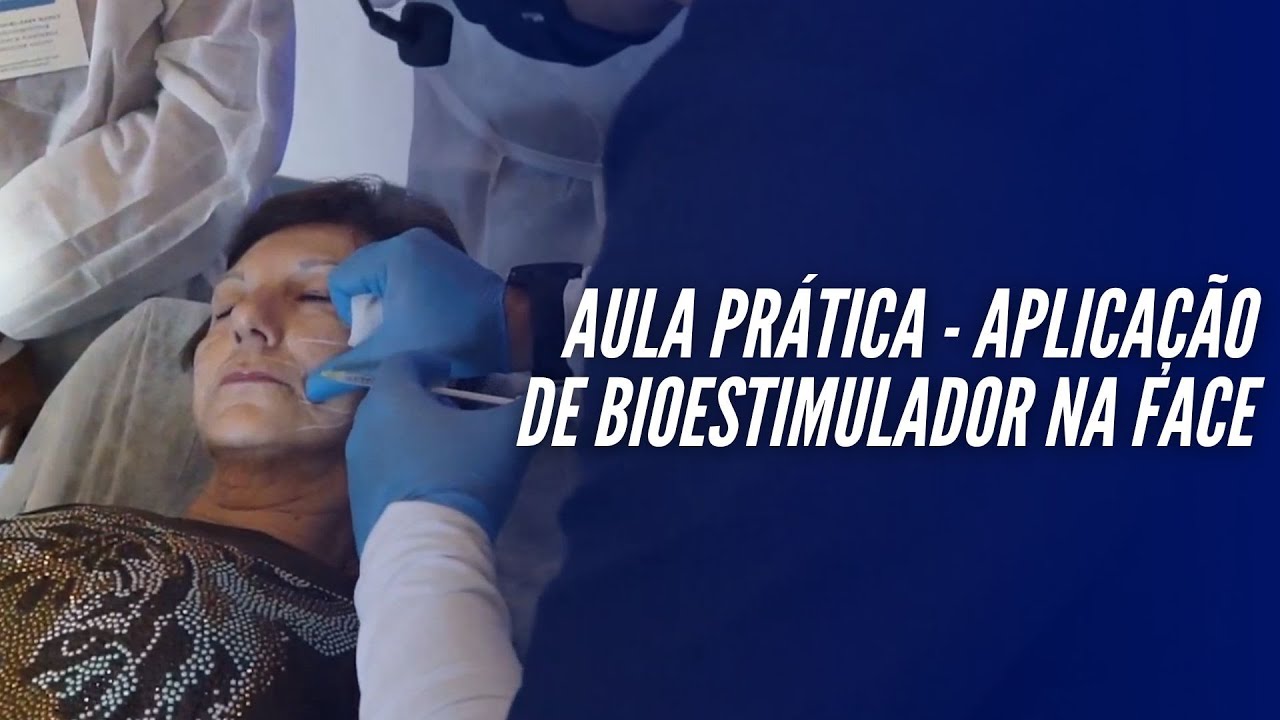 AULA PRÁTICA - aplicação de bioestimulador na face