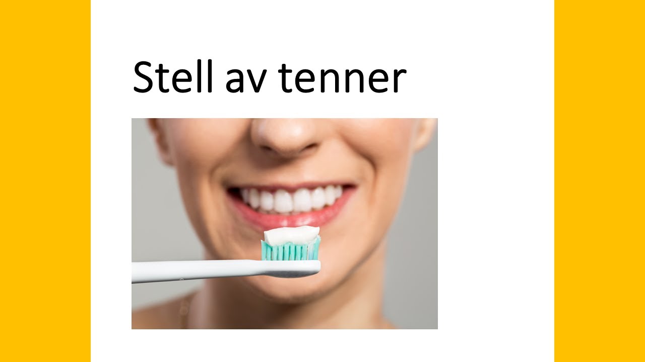 Stell av tenner