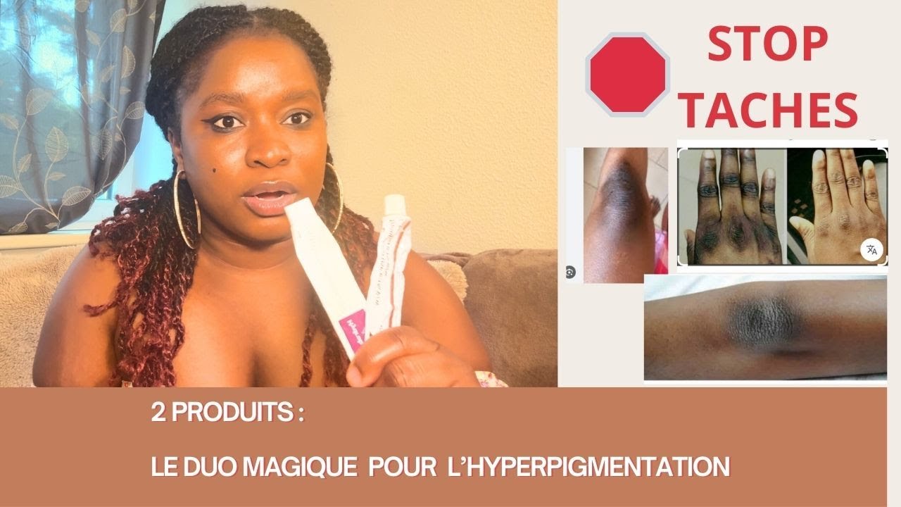 "Hyperpigmentation : La Routine PUISSANTE qui Efface les Taches (Résultat Visible !)"