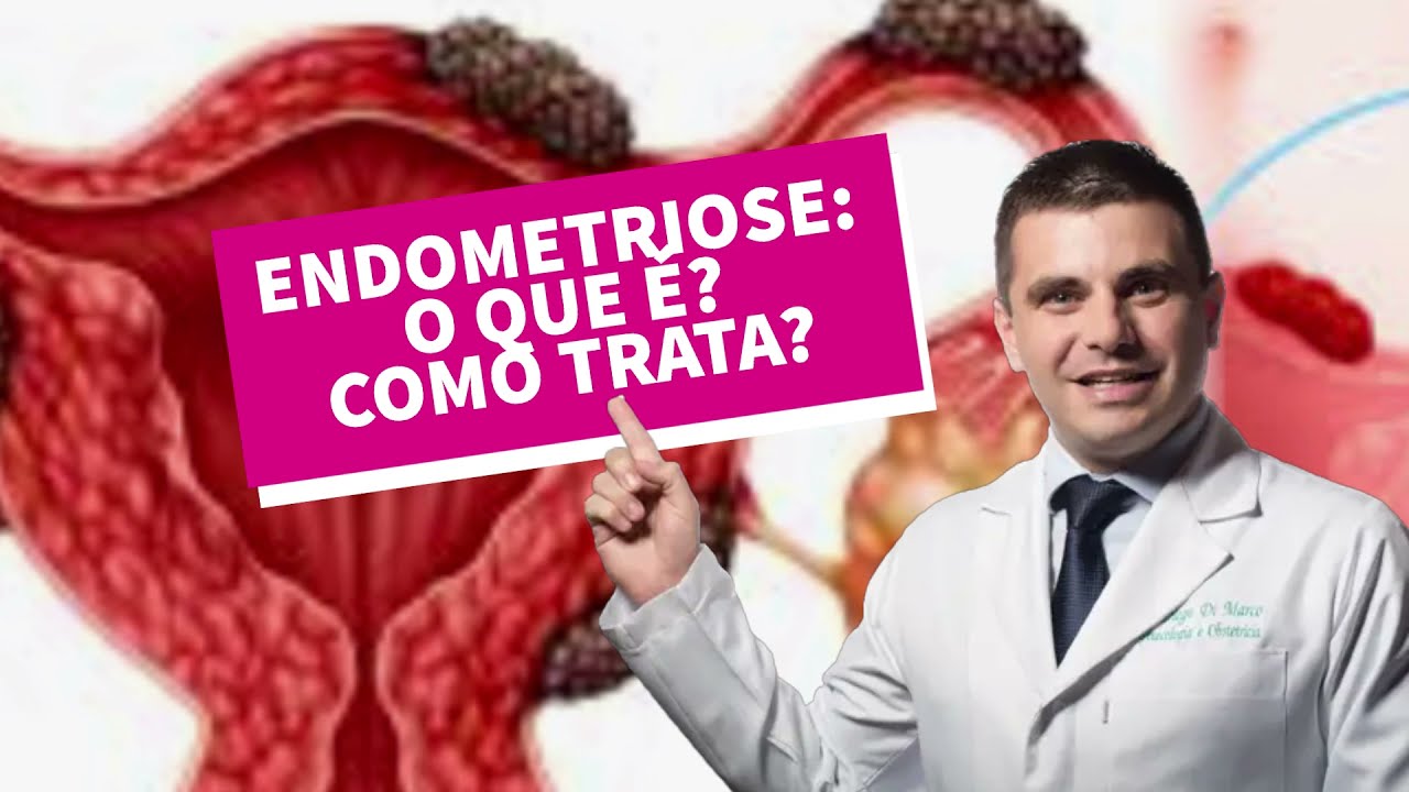 Endometriose - o que é, e como é o tratamento?